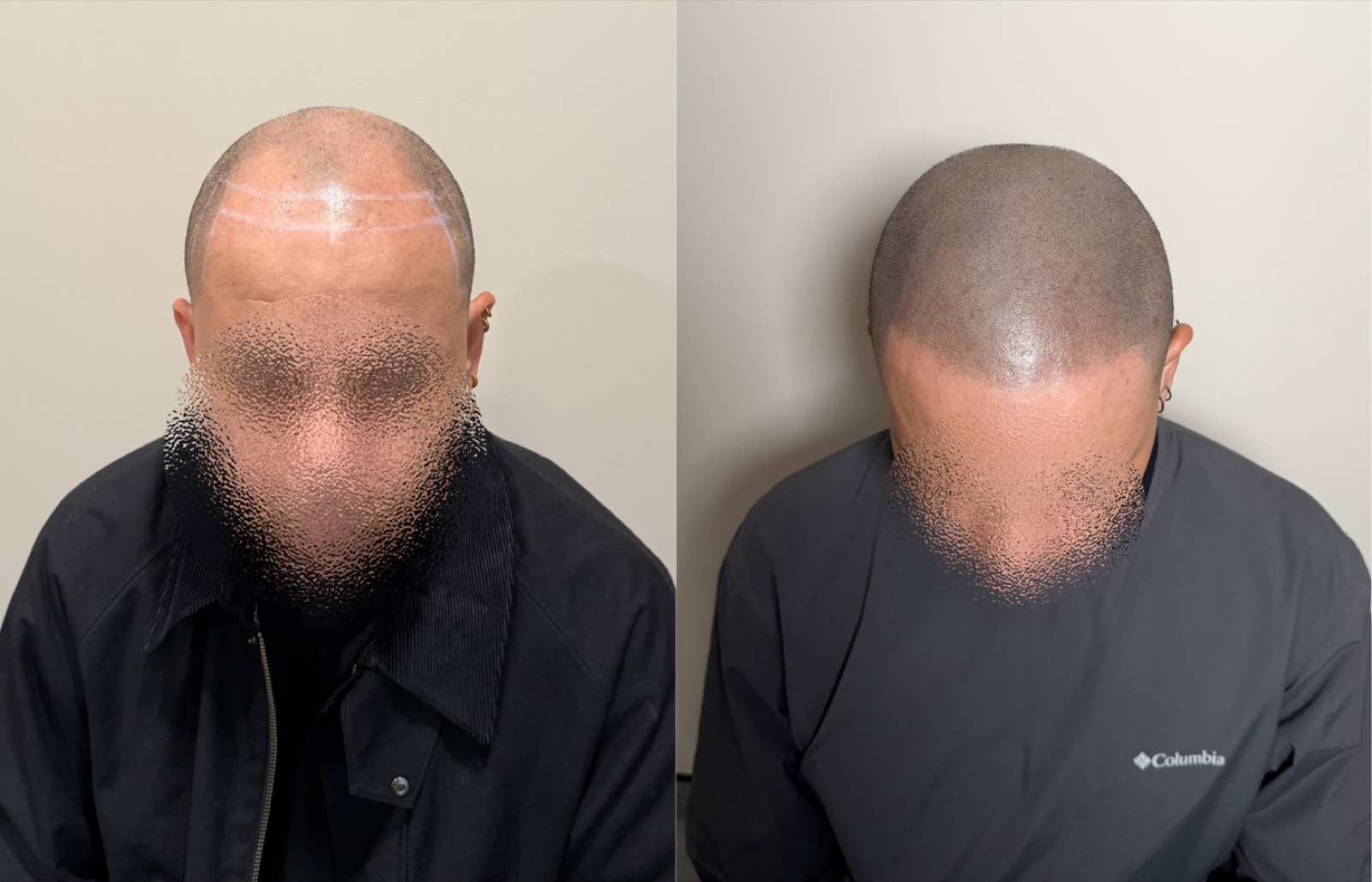 Shaved look SMP portfolio 14